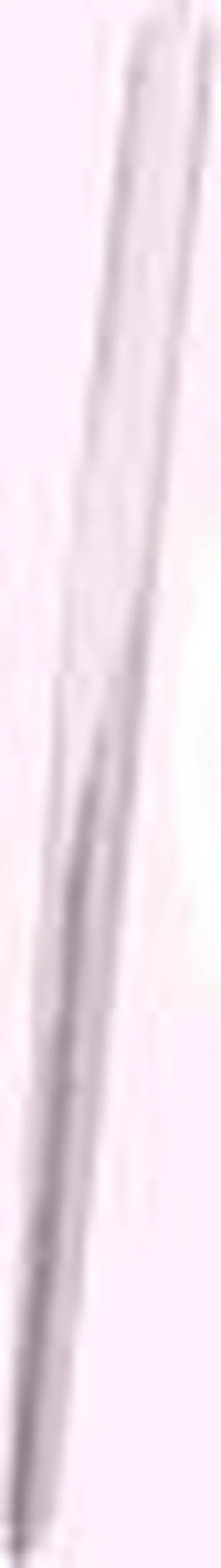 Рамка, облицовка радиатора KLOKKERHOLM купить